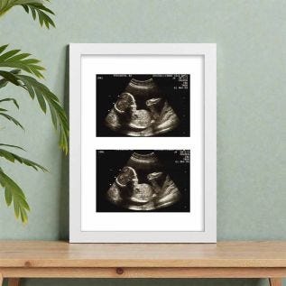 max_20x16printframeblackportrait_26x4baby.jpg