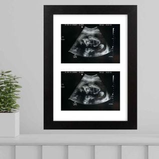 Baby-Scan-2-Image-Print-Frame-A4-Black.jpg