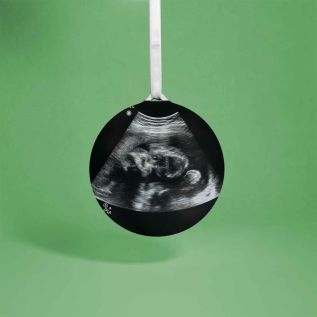 Baby-Scan-Full-Image-Hanging-Decoration.jpg